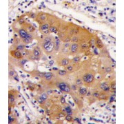 Nicotinamide N-Methyltransferase (NNMT) Antibody