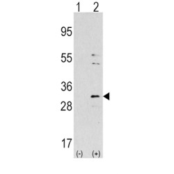 Nicotinamide N-Methyltransferase (NNMT) Antibody