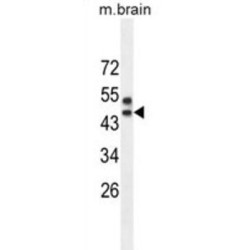 Sprouty-Related, EVH1 Domain-Containing Protein 3 (SPRED3) Antibody