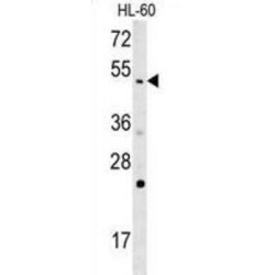 Carboxyl-Terminal PDZ Ligand of Neuronal Nitric Oxide Synthase Protein (NOS1AP) Antibody