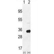 Ribosomal Protein S6 (RPS6) Antibody