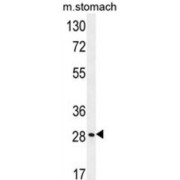 Breast Cancer Metastasis-Suppressor 1-Like Protein (BRMS1L) Antibody