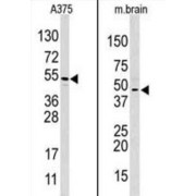 Hypoxia Inducible Factor 1 Alpha Inhibitor (HIF1AN) Antibody