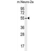 Probable Palmitoyltransferase ZDHHC1 (ZDHHC1) Antibody