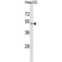 Probable Palmitoyltransferase ZDHHC1 (ZDHHC1) Antibody