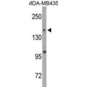 DNA Methyltransferase 1 (DNMT1) Antibody