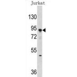 DNA Methyltransferase 3 Alpha (Dnmt3a) Antibody