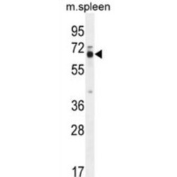 Leiomodin-2 (LMOD2) Antibody