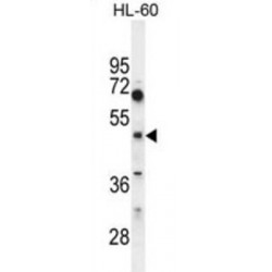 Choline/Ethanolaminephosphotransferase 1 (CEPT1) Antibody