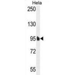 Elongation Factor Tu GTP-Binding Domain-Containing Protein 1 (EFTUD1) Antibody