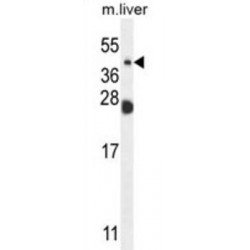 Sialidase 4 (NEU4) Antibody