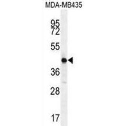 Homeobox Protein Aristaless-Like 4 (ALX4) Antibody