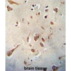 Neuroserpin (SERPINI1) Antibody