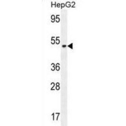 Neuroserpin (SERPINI1) Antibody