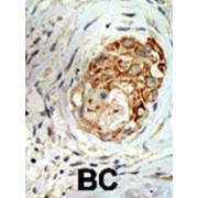 Methyl-CpG Binding Domain Protein 3 (MBD3) Antibody