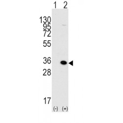 Methyl-CpG Binding Domain Protein 3 (MBD3) Antibody