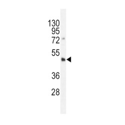 DNA Methyltransferase 3 Like (Dnmt3L) Antibody