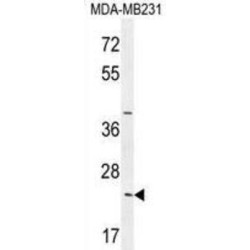 Synaptonemal Complex Central Element Protein 2 (SYCE2) Antibody