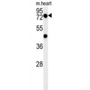 Putative Homeodomain Transcription Factor 2 (PHTF2) Antibody