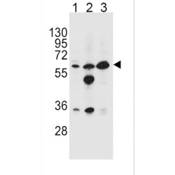 Glycine Amidinotransferase, Mitochondrial (GATM) Antibody