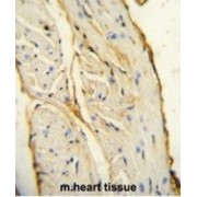 Allograft Inflammatory Factor 1 (AIF1) Antibody