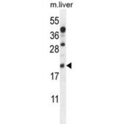 Allograft Inflammatory Factor 1 (AIF1) Antibody