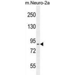 DEAD/H-Box Helicase 11 (DDX11) Antibody