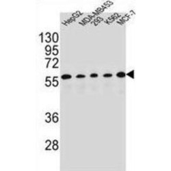 Paired Box Protein Pax-1 (PAX1) Antibody