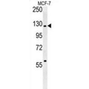 Western blot analysis of MCF-7 cell lysates (35 µg per lane) using Rab GTPase-Activating Protein 1 Antibody.