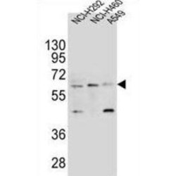 Leukocyte Immunoglobulin Like Receptor A2 (LILRA2) Antibody