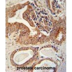 Insulin Like Growth Factor 2 mRNA Binding Protein 1 (IGF2BP1) Antibody