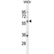 WB analysis of WiDr cell line lysates (35 µg/lane), using BCMO1 antibody.