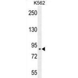 Chloride Intracellular Channel 6 (CLIC6) Antibody