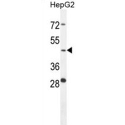 Cathepsin A (CTSA) Antibody