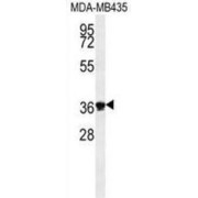 Exonuclease V (EXO5) Antibody