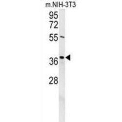 Exonuclease V (EXO5) Antibody