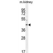 E2F Transcription Factor 2 (E2F2) Antibody