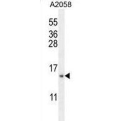 Mitochondrial Ribosomal Protein S24 (MRPS24) Antibody