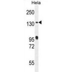 DENN Domain-Containing Protein 5A (DEN5A) Antibody