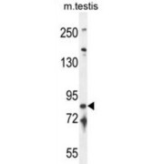 Intraflagellar Transport Protein 81 Homolog (IFT81) Antibody