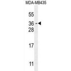 Myc Target Protein 1 (MYCT1) Antibody