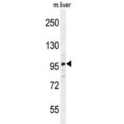 NMDA Receptor-Regulated Protein 2 (NARG2) Antibody