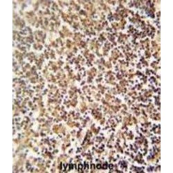 Zinc Finger Protein 98 (ZNF98) Antibody