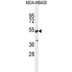 Zinc Finger Protein 98 (ZNF98) Antibody