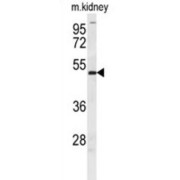 Doublesex And Mab-3 Related Transcription Factor 3 (DMRT3) Antibody