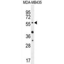 RAC-Alpha Serine/threonine-Protein Kinase (AKT1) Antibody