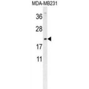 Doublesex- And Mab-3-Related Transcription Factor C1 (DMRTC1) Antibody