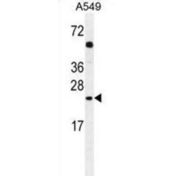 GOLGA2L1 Antibody