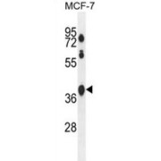 Spermatogenesis Associated 2 Like (SPATA2L) Antibody