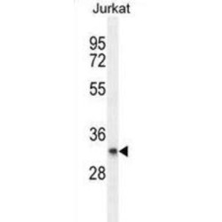 Transmembrane Gamma-Carboxyglutamic Acid Protein 3 (PRRG3) Antibody